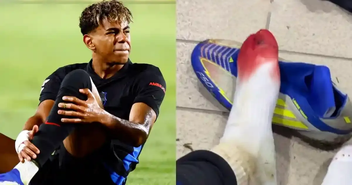 lamine yamal shares video of blood stained foot raises concern over player safety and referee decisions
